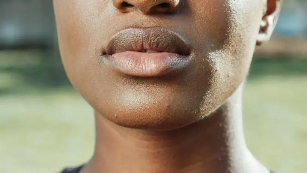 13 Surprising Signs of Bruxism You Shouldn’t Ignore