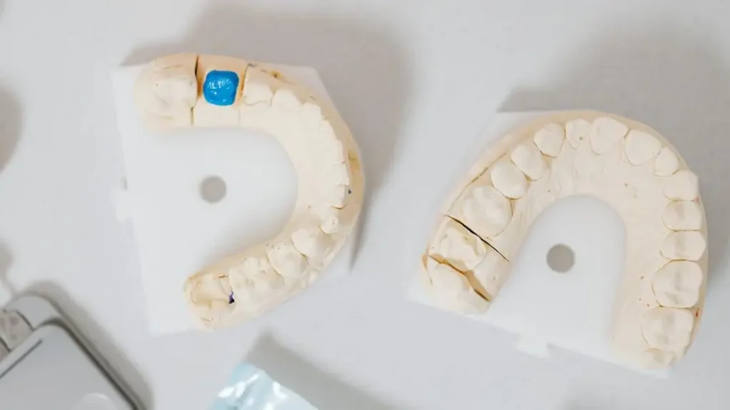 Dental Implants Cookstown, Innisfil: What Are Your Options?