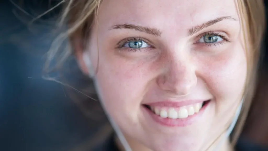 Everything You Need to Know About Smile Makeovers