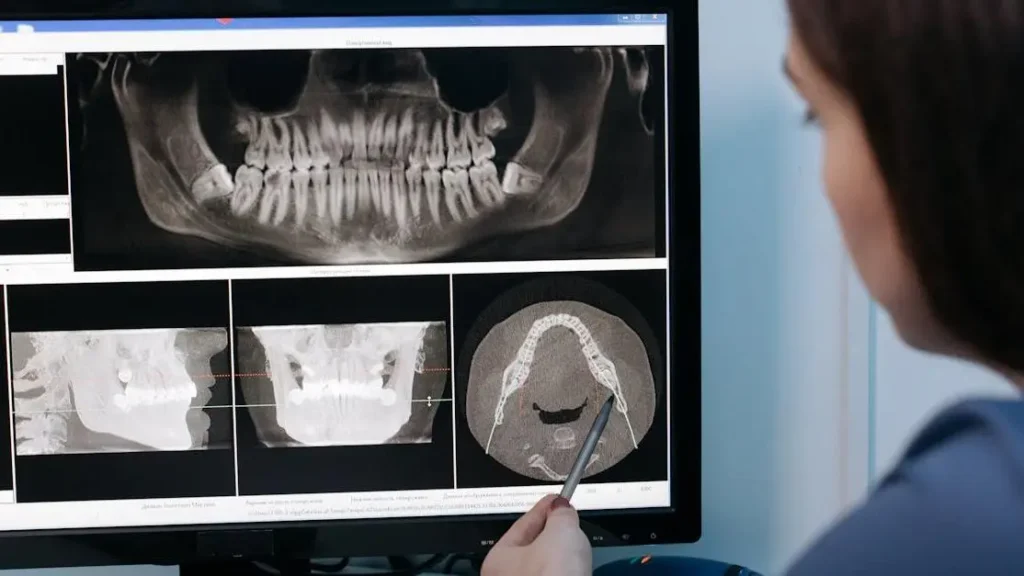 How Long Do Dental Crowns Last: Find Out Here