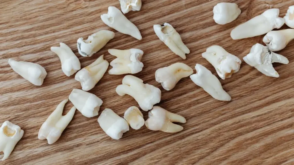Implant vs. Traditional Bridge: What’s the Difference?