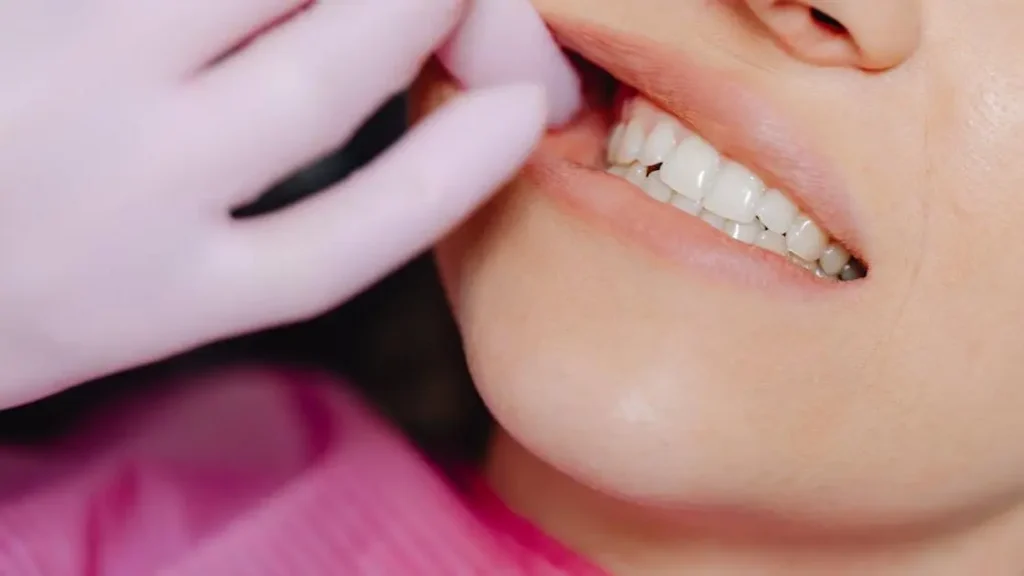 The Cost of Dental Implants: What You Should Know