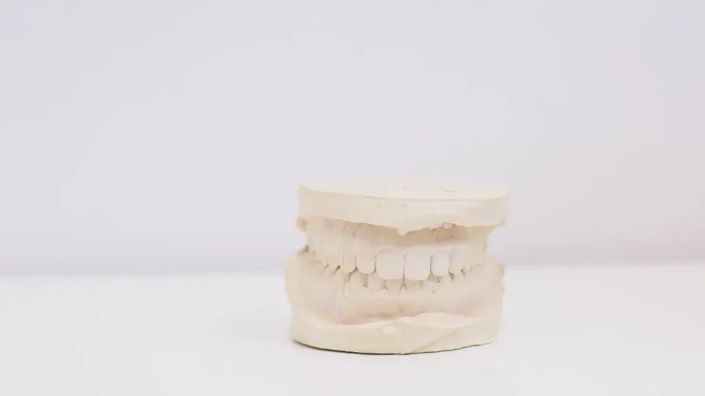 What Are Crossbite Signs, Effects, and Treatments? Get Clear Answers