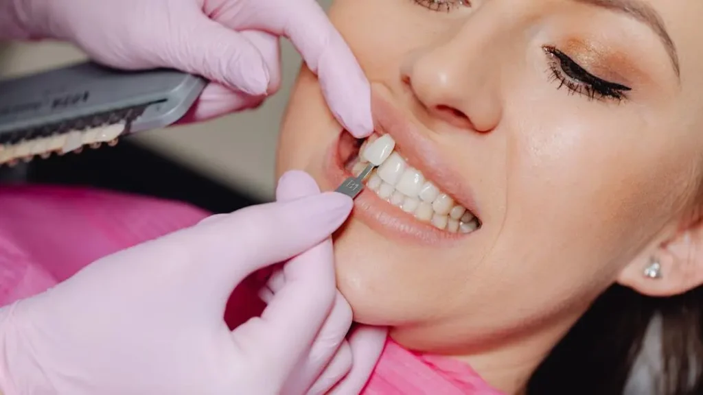 What Are Dental Inlays and Onlays: A Simple Guide