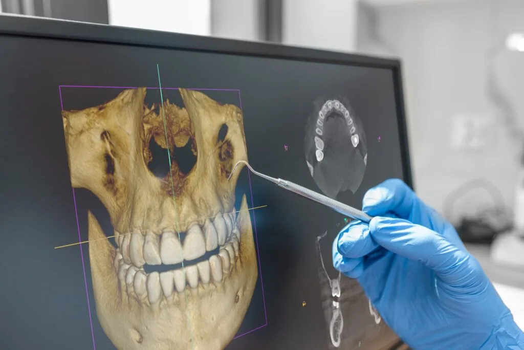 cbct-3-d-scanning-technology-in-cookstown-on