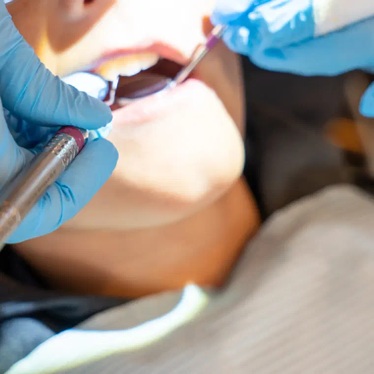 A patient receiving a professional teeth cleaning at Cookstown Dental Centre