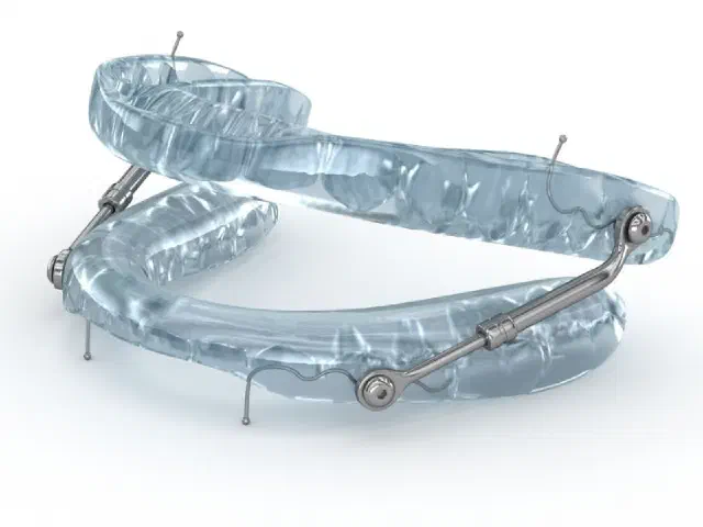 Patient discussing custom sleep apnea appliance treatment