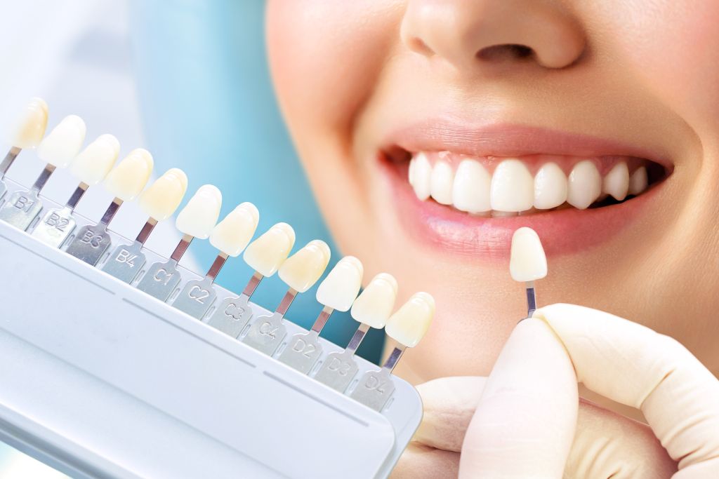 porcelain veneers near you