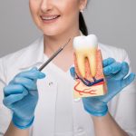 when-do-you-actually-need-a-root-canal